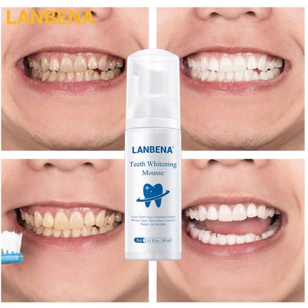 Lanbena Teeth Whitening Mousse Oral Hygiene Cleaning